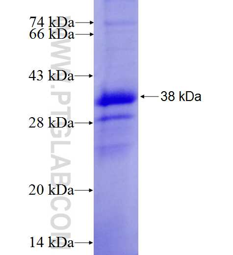 PLEKHM1 fusion protein Ag9150 SDS-PAGE