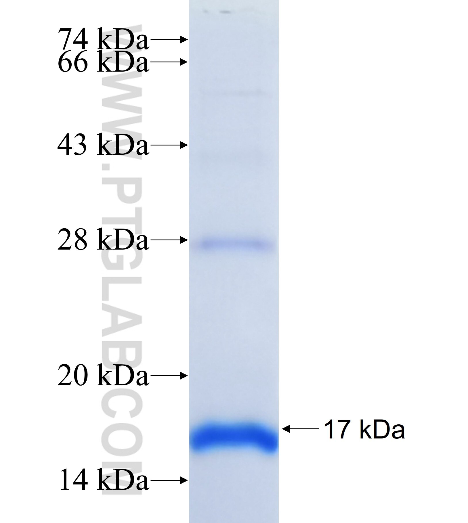 PLEKHM2 fusion protein Ag41226 SDS-PAGE PLEKHM2 fusion protein Ag41226 SDS-PAGE