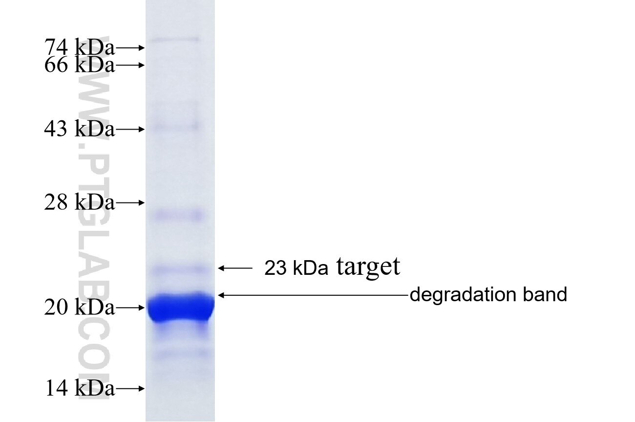 PLEKHN1 fusion protein Ag38874 SDS-PAGE