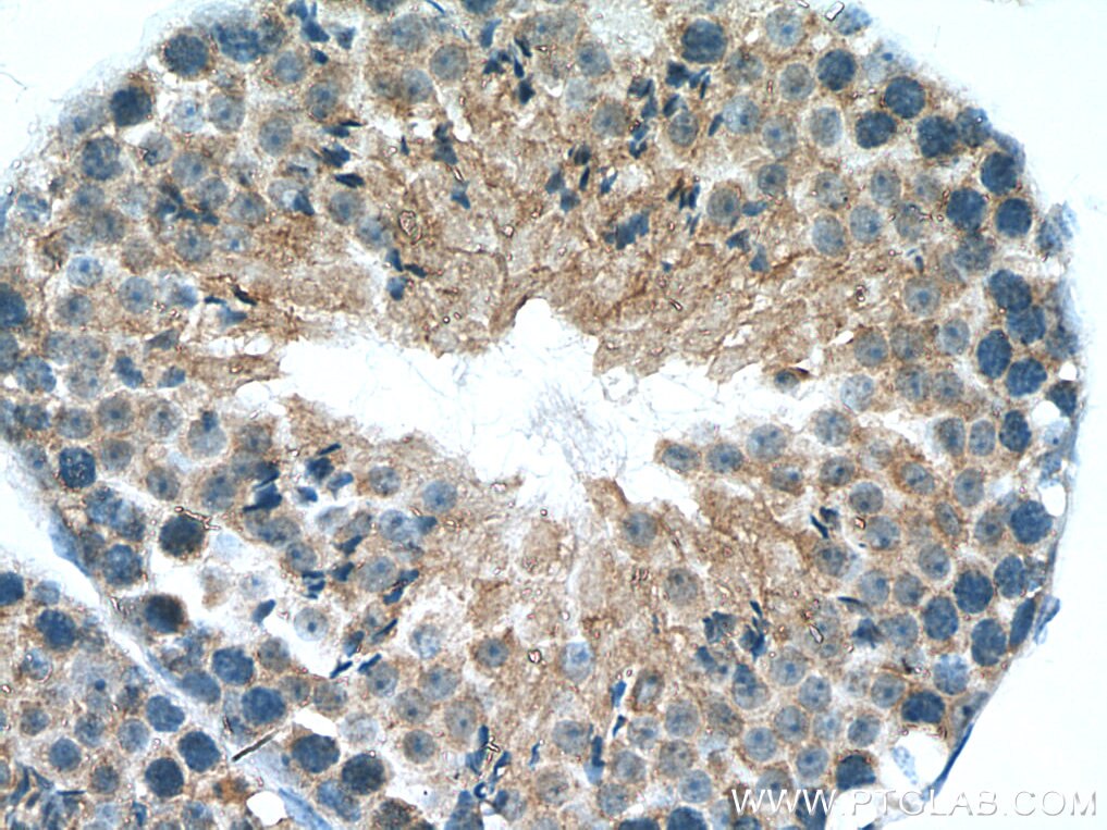 IHC staining of mouse testis using 24883-1-AP