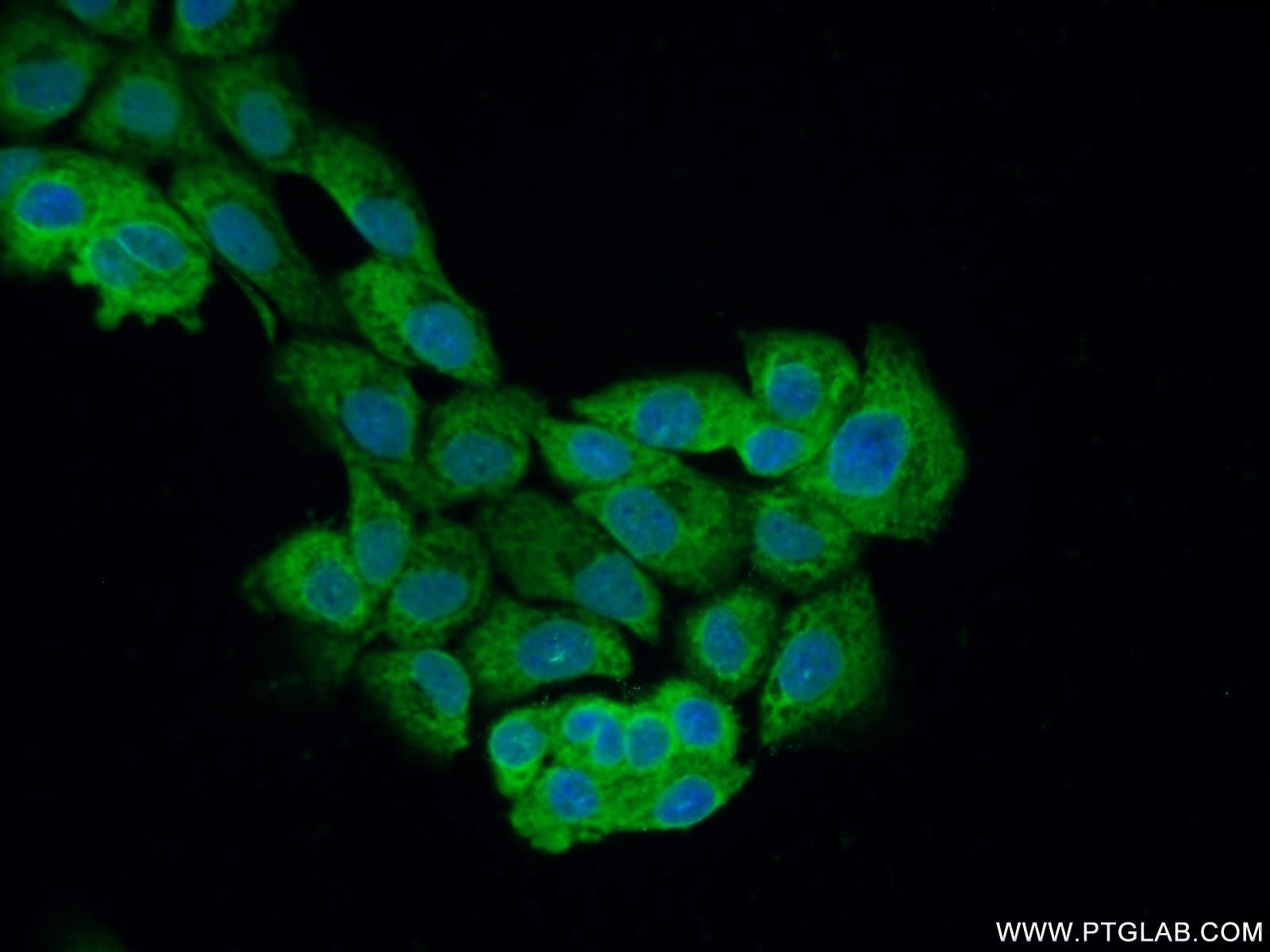 Immunofluorescence (IF) / fluorescent staining of A431 cells using PLEKHO2 Polyclonal antibody (21356-1-AP)