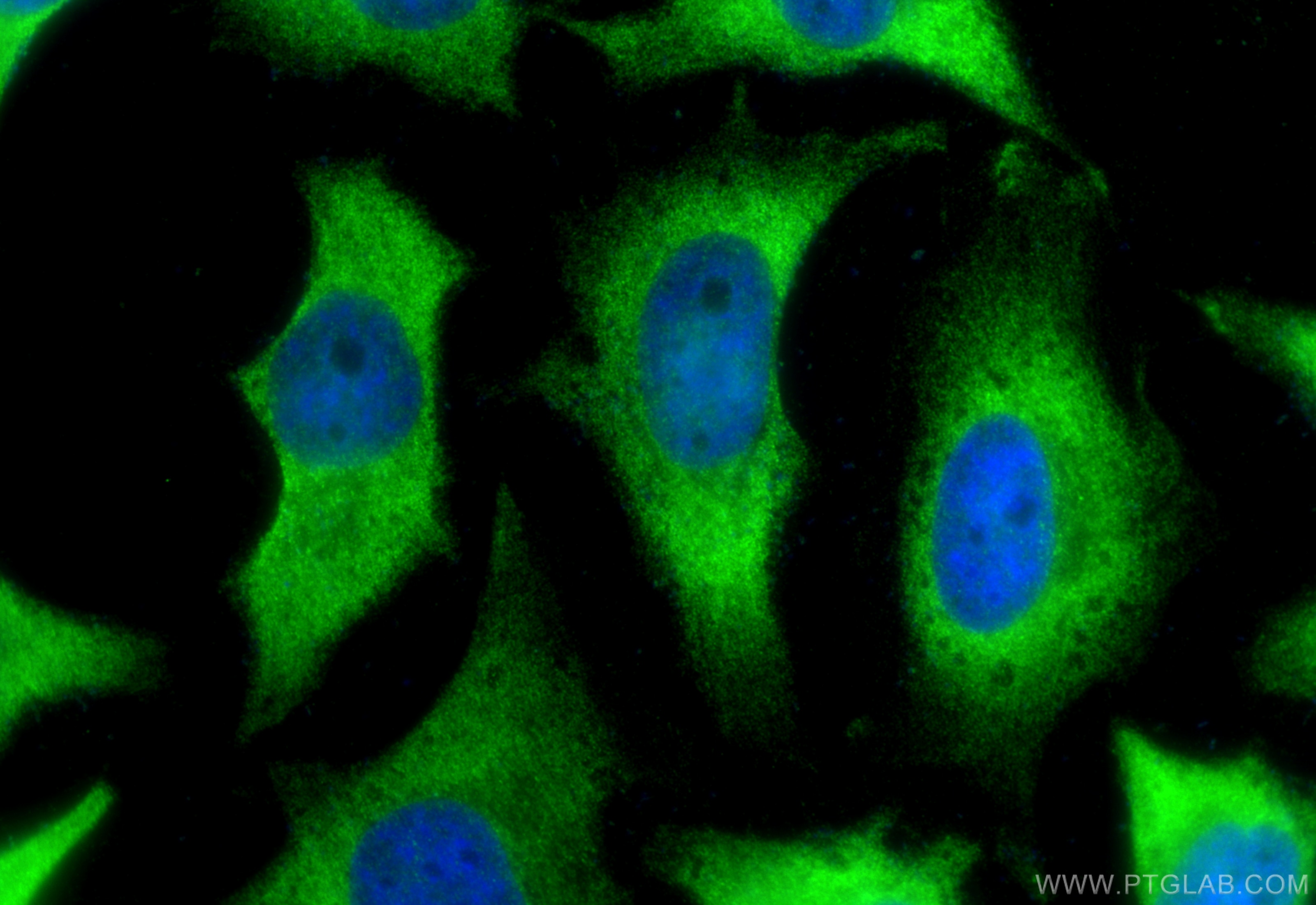 Immunofluorescence (IF) / fluorescent staining of HeLa cells using PLEKHO2 Polyclonal antibody (21356-1-AP)