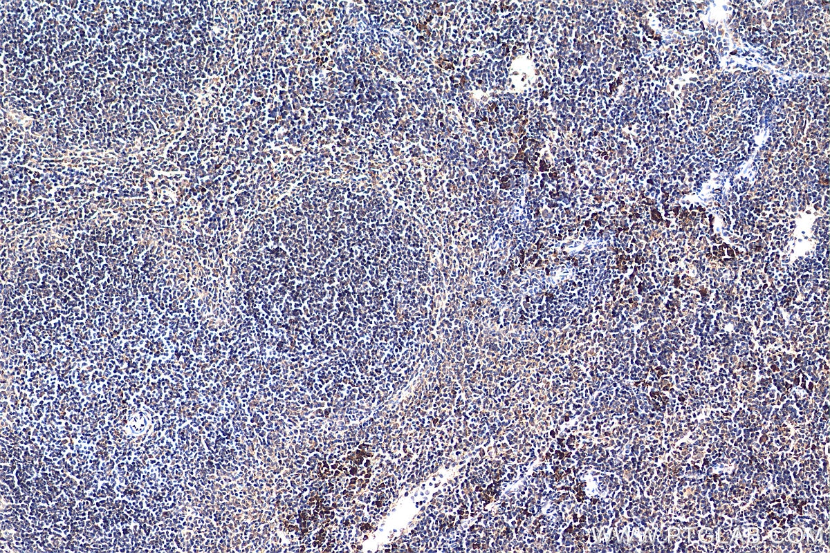 Immunohistochemistry (IHC) staining of mouse spleen tissue using PLEKHO2 Polyclonal antibody (21356-1-AP)