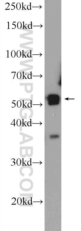 Western Blot (WB) analysis of HeLa cells using PLEKHO2 Polyclonal antibody (21356-1-AP)