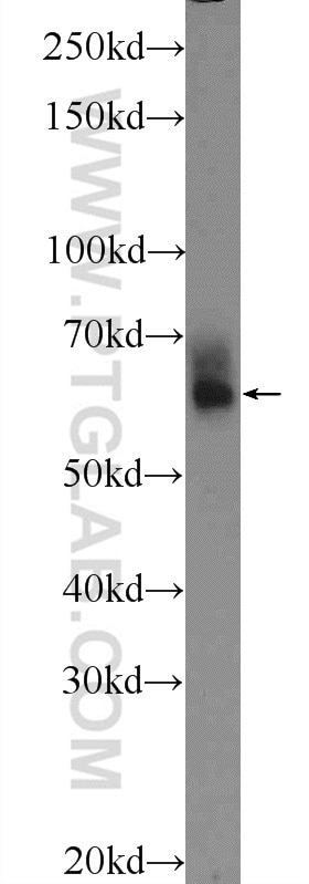 Western Blot (WB) analysis of mouse thymus tissue using PLEKHO2 Polyclonal antibody (21356-1-AP)