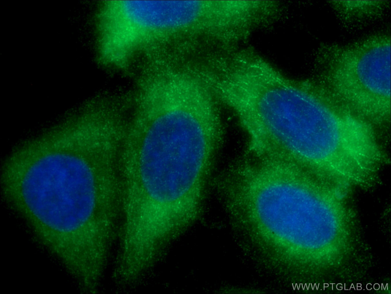 IF Staining of HepG2 using 17462-1-AP