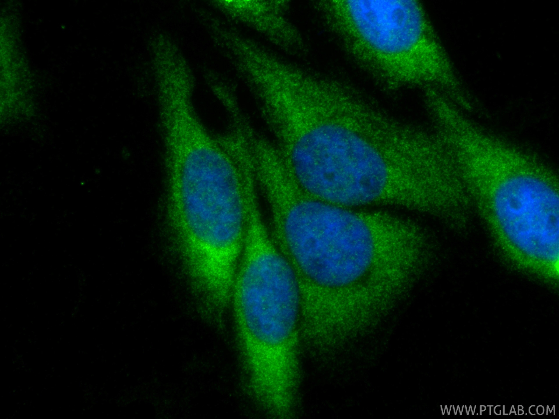 Immunofluorescence (IF) / fluorescent staining of HepG2 cells using Plasminogen Polyclonal antibody (17462-1-AP)