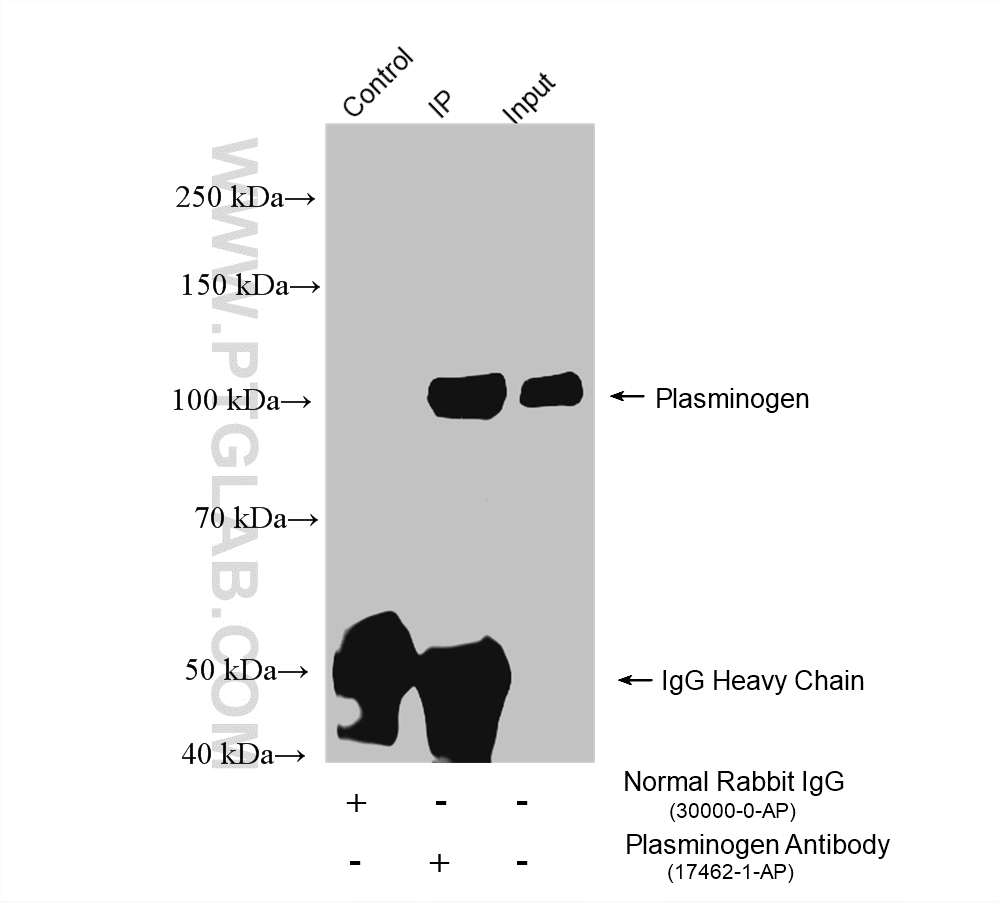 Immunoprecipitation (IP) experiment of human plasma using Plasminogen Polyclonal antibody (17462-1-AP)