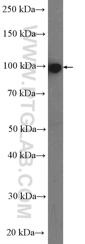 Western Blot (WB) analysis of human blood using Plasminogen Polyclonal antibody (17462-1-AP)