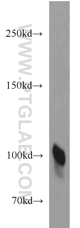 Western Blot (WB) analysis of human placenta tissue using Plasminogen Polyclonal antibody (17462-1-AP)