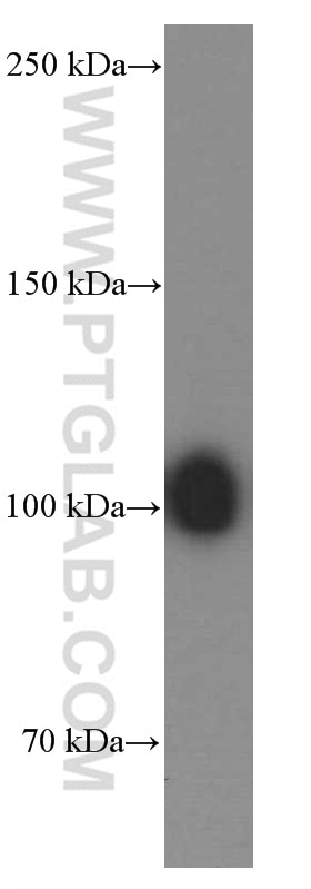 Western Blot (WB) analysis of human plasma using Plasminogen Monoclonal antibody (66399-1-Ig)