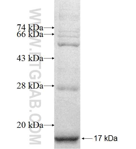 PLGLB2 fusion protein Ag9878 SDS-PAGE PLGLB2 fusion protein Ag9878 SDS-PAGE