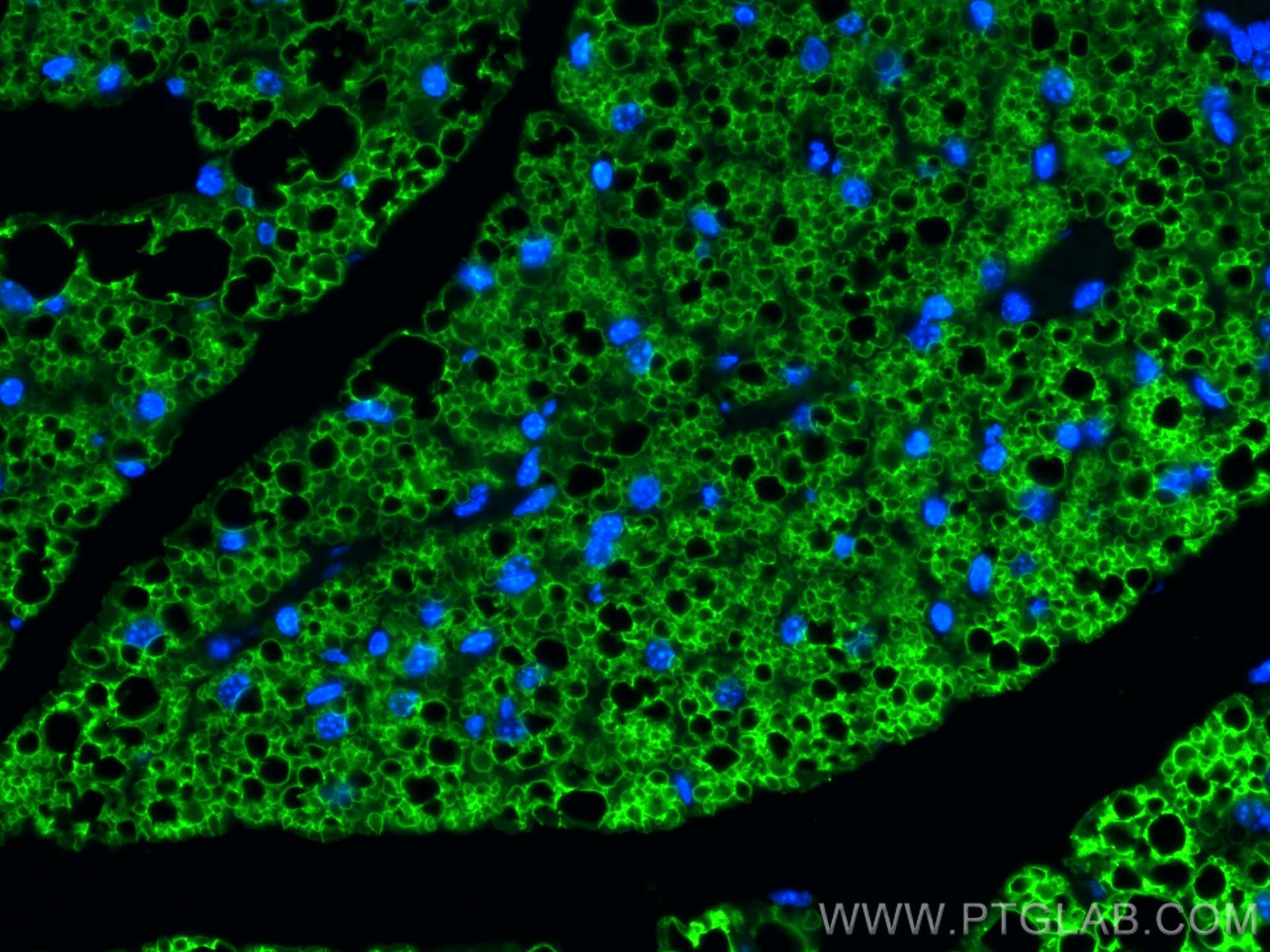 Immunofluorescence (IF) / fluorescent staining of mouse brown adipose tissue using Perilipin 1 Polyclonal antibody (27716-1-AP)