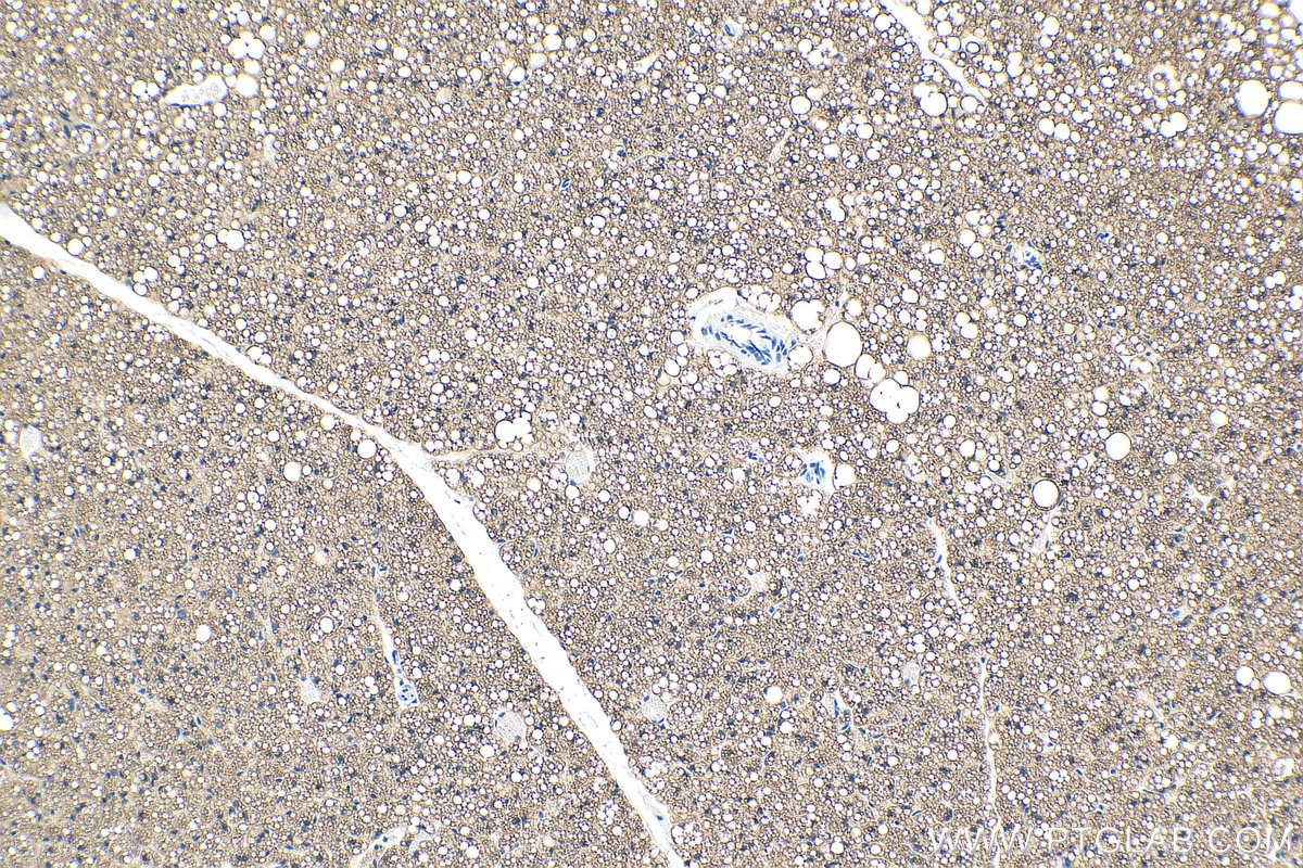 Immunohistochemistry (IHC) staining of mouse brown adipose tissue using Perilipin 1 Polyclonal antibody (27716-1-AP)