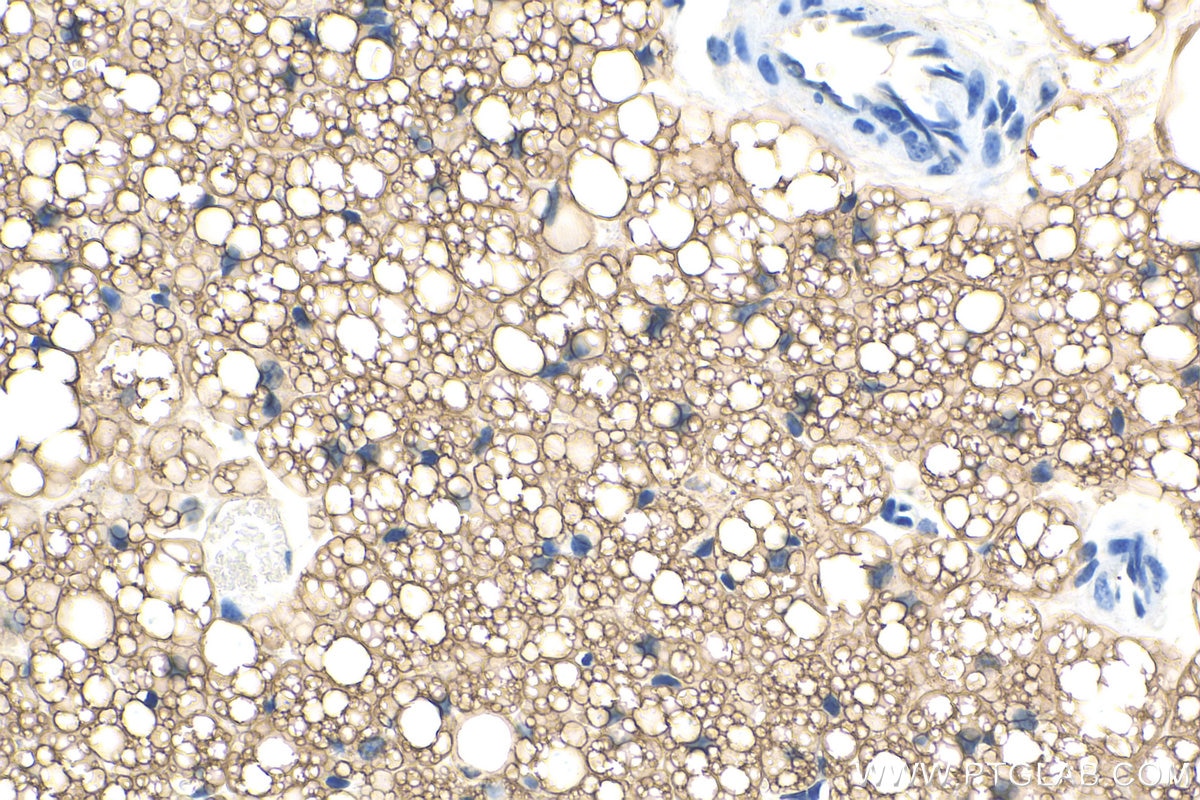 Immunohistochemistry (IHC) staining of mouse brown adipose tissue using Perilipin 1 Polyclonal antibody (27716-1-AP)