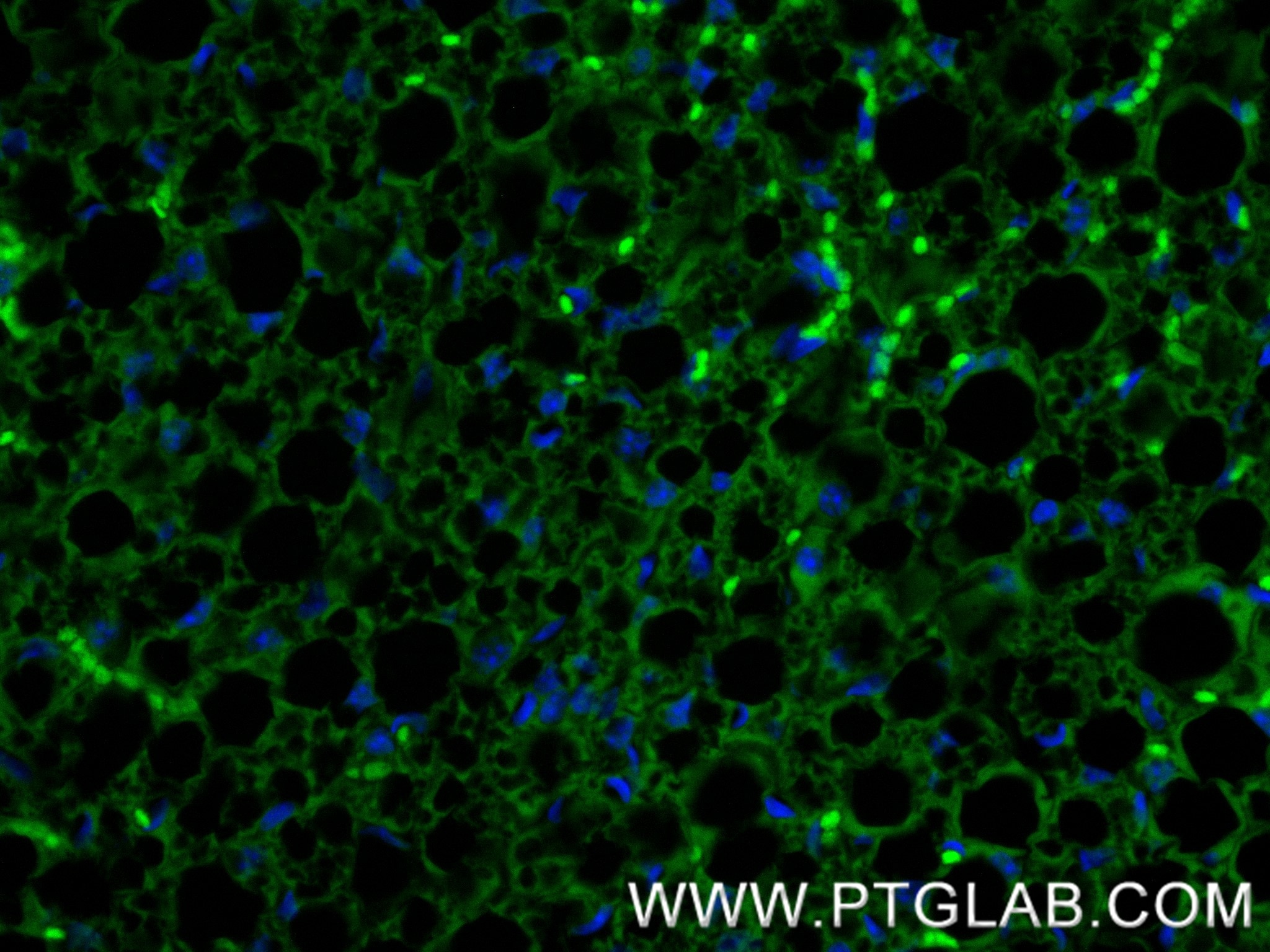 IF Staining of mouse brown adipose using 83905-4-RR Immunofluorescence (IF) / fluorescent staining of mouse brown adipose tissue using Perilipin 1 Recombinant monoclonal antibody (83905-4-RR)