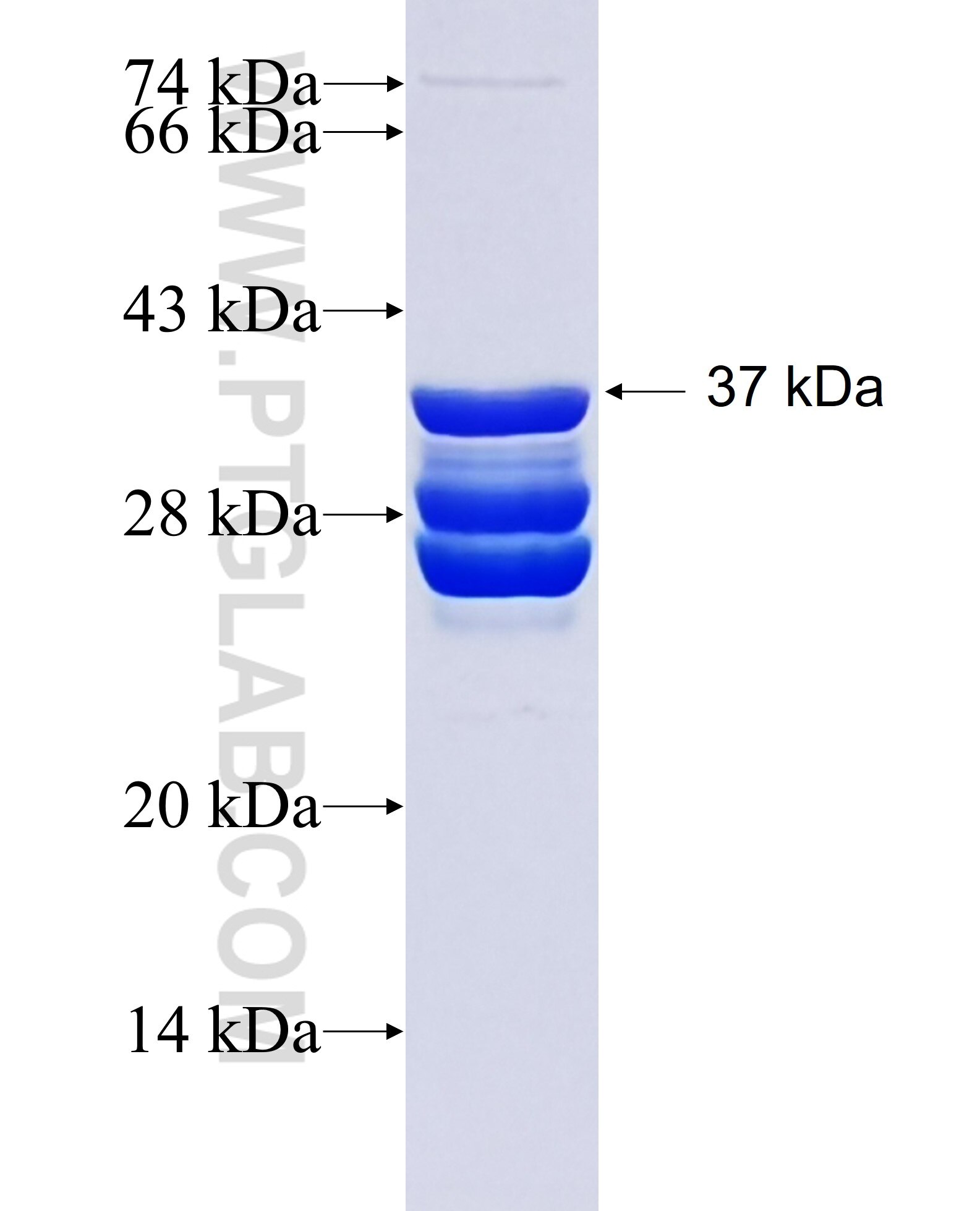 PLIN1 fusion protein Ag26426 SDS-PAGE