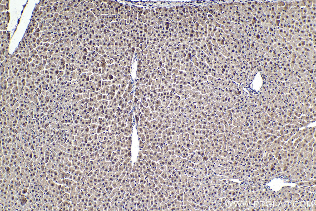 Immunohistochemistry (IHC) staining of rat liver tissue using PLK1 Polyclonal antibody (10305-1-AP)