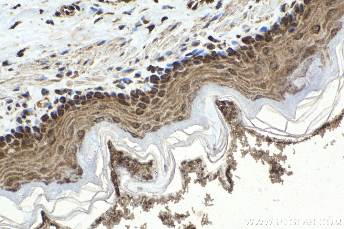 Immunohistochemistry (IHC) staining of rat stomach tissue using PLK1 Polyclonal antibody (10305-1-AP)