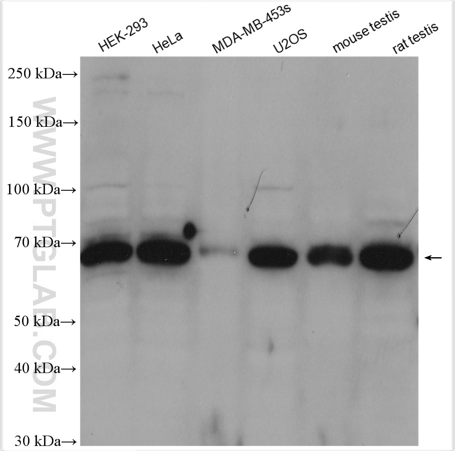 Western Blot (WB) analysis of various lysates using PLK1 Polyclonal antibody (10305-1-AP)