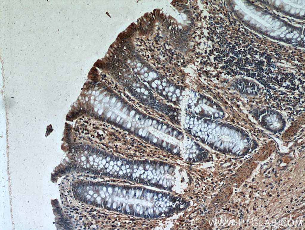 IHC staining of human colon using 19553-1-AP