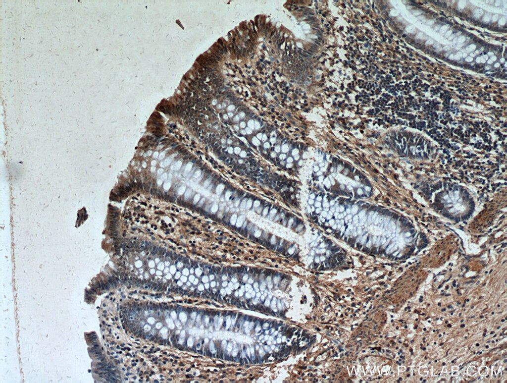 Immunohistochemistry (IHC) staining of human colon tissue using Phospho-PLK1 (Ser326) Polyclonal antibody (19553-1-AP)