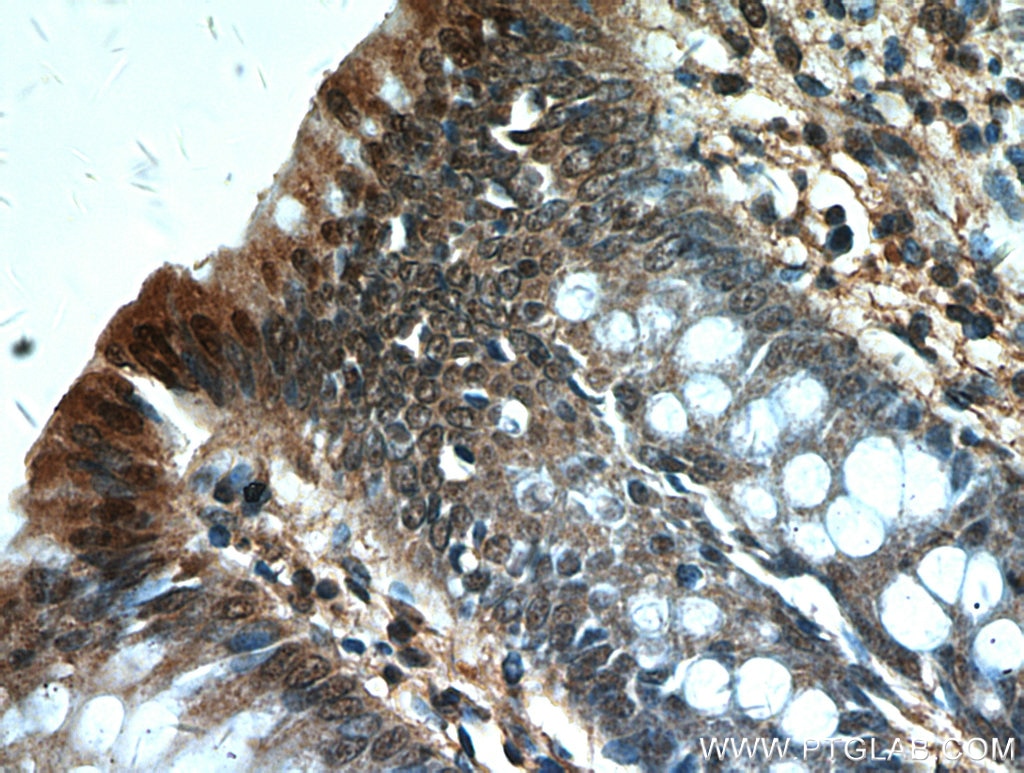 IHC staining of human colon using 19553-1-AP