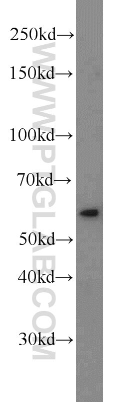 Western Blot (WB) analysis of MCF-7 cells using Phospho-PLK1 (Ser326) Polyclonal antibody (19553-1-AP)
