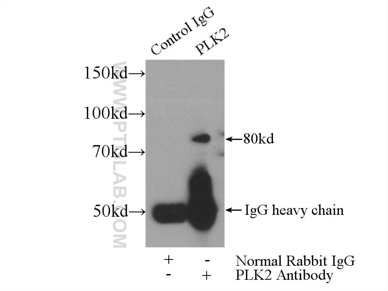 Immunoprecipitation (IP) experiment of HeLa cells using PLK2 Polyclonal antibody (15956-1-AP)