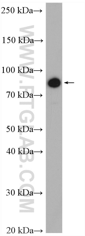 Western Blot (WB) analysis of MCF-7 cells using PLK2 Polyclonal antibody (15956-1-AP)