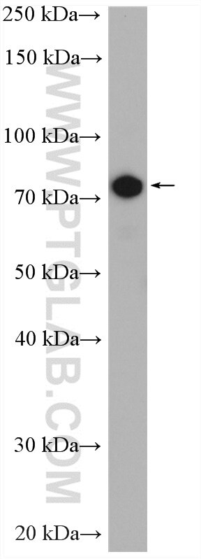 Western Blot (WB) analysis of HeLa cells using PLK2 Polyclonal antibody (15956-1-AP)
