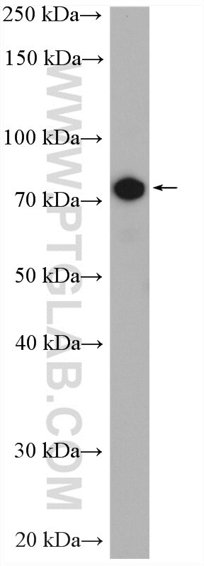 WB analysis of HeLa using 15956-1-AP