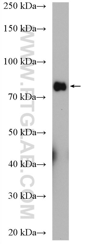 Western Blot (WB) analysis of COLO 320 cells using PLK2 Polyclonal antibody (15956-1-AP)