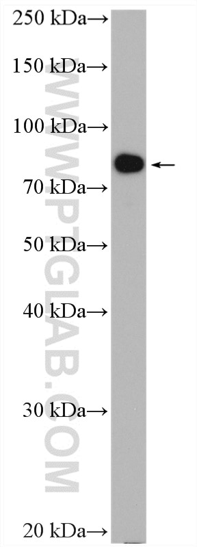 Western Blot (WB) analysis of COLO 320 cells using PLK2 Polyclonal antibody (15956-1-AP)