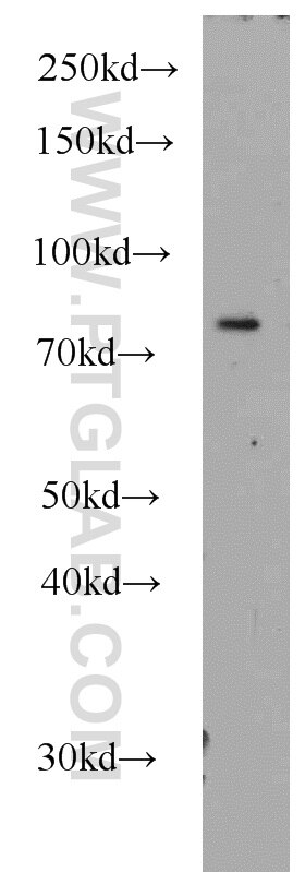 PLK2 Polyclonal antibody