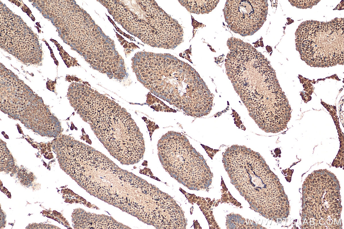 Immunohistochemistry (IHC) staining of mouse testis tissue using PLK3 Polyclonal antibody (10977-1-AP)