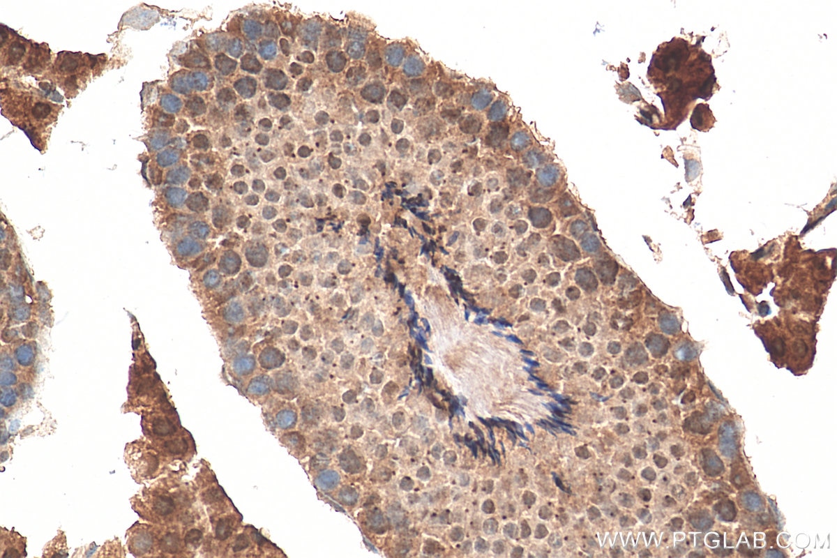Immunohistochemistry (IHC) staining of mouse testis tissue using PLK3 Polyclonal antibody (10977-1-AP)