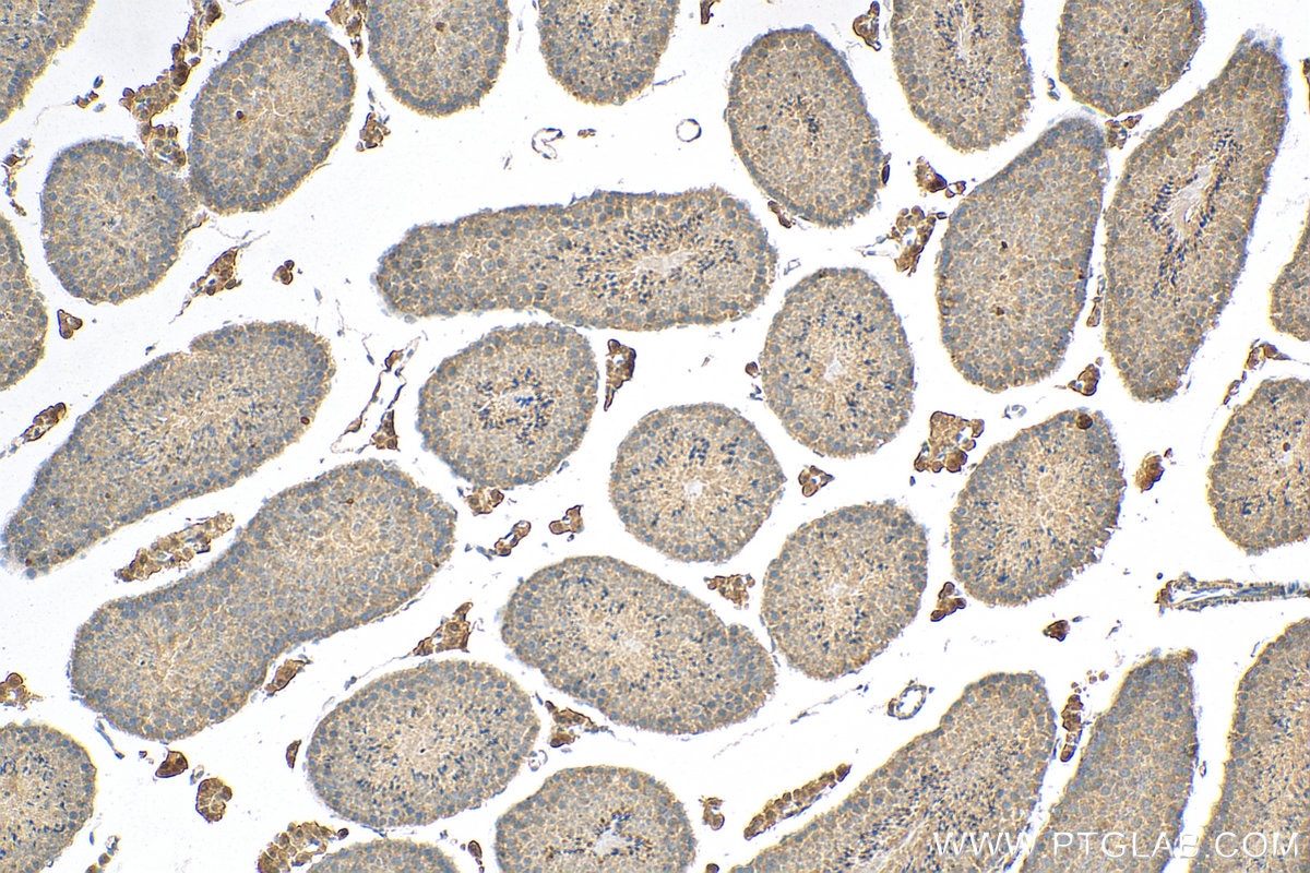 Immunohistochemistry (IHC) staining of mouse testis tissue using PLK4 Polyclonal antibody (12952-1-AP)