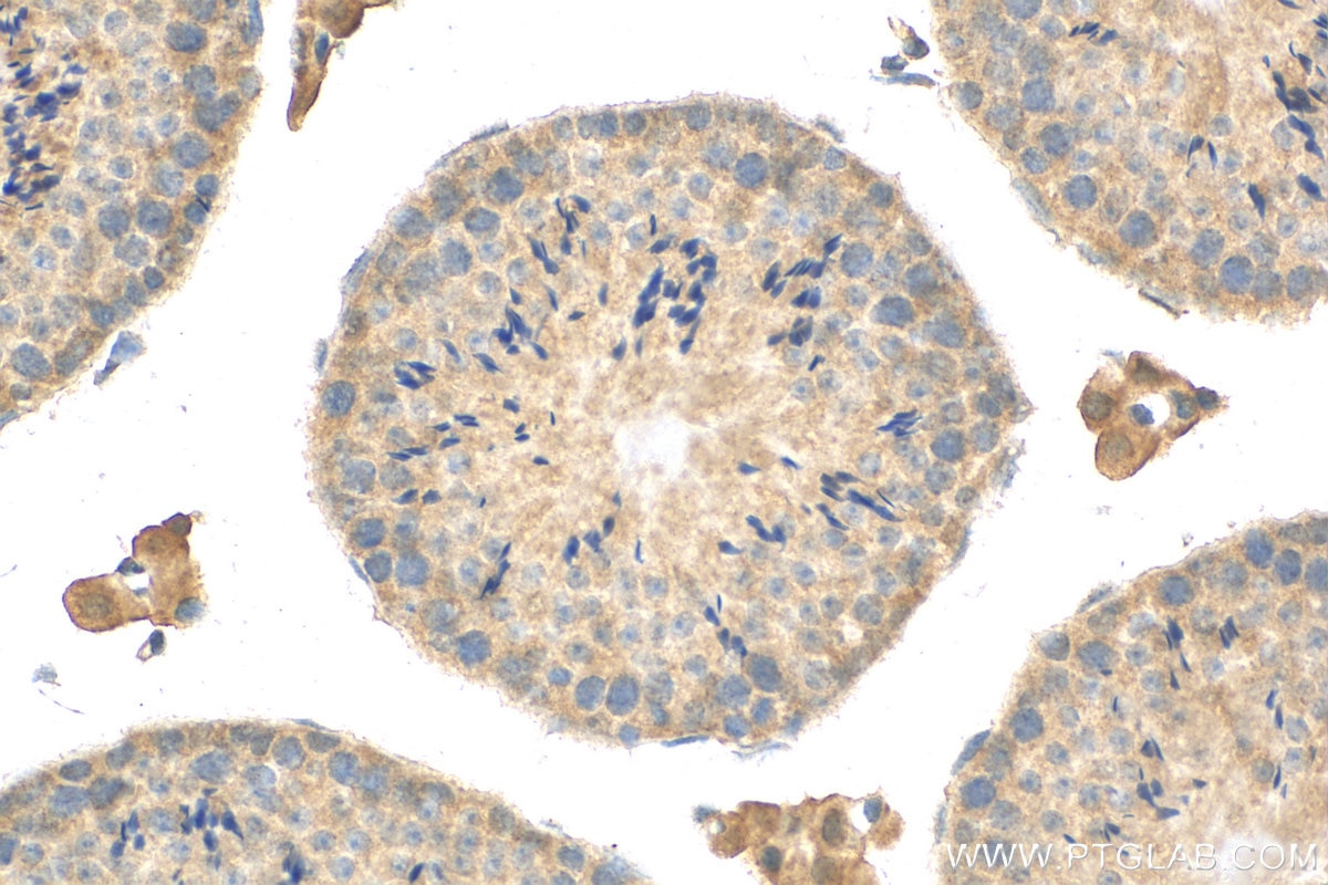 Immunohistochemistry (IHC) staining of mouse testis tissue using PLK4 Polyclonal antibody (12952-1-AP)