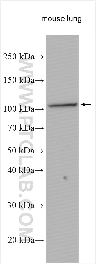 Western Blot (WB) analysis of various lysates using PLK4 Polyclonal antibody (12952-1-AP)