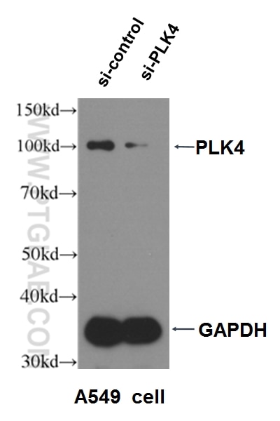 Western Blot (WB) analysis of A549 cells using PLK4 Polyclonal antibody (12952-1-AP)