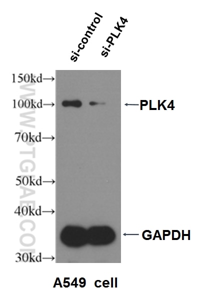 WB analysis of A549 cells using 12952-1-AP