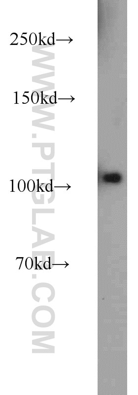 PLK4 Polyclonal antibody