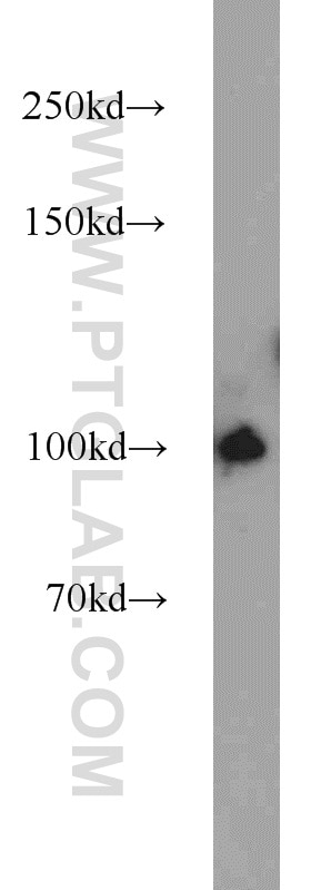 Western Blot (WB) analysis of MCF-7 cells using PLK4 Polyclonal antibody (12952-1-AP)