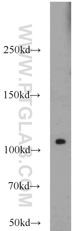 Western Blot (WB) analysis of A549 cells using PLK4 Polyclonal antibody (12952-1-AP)