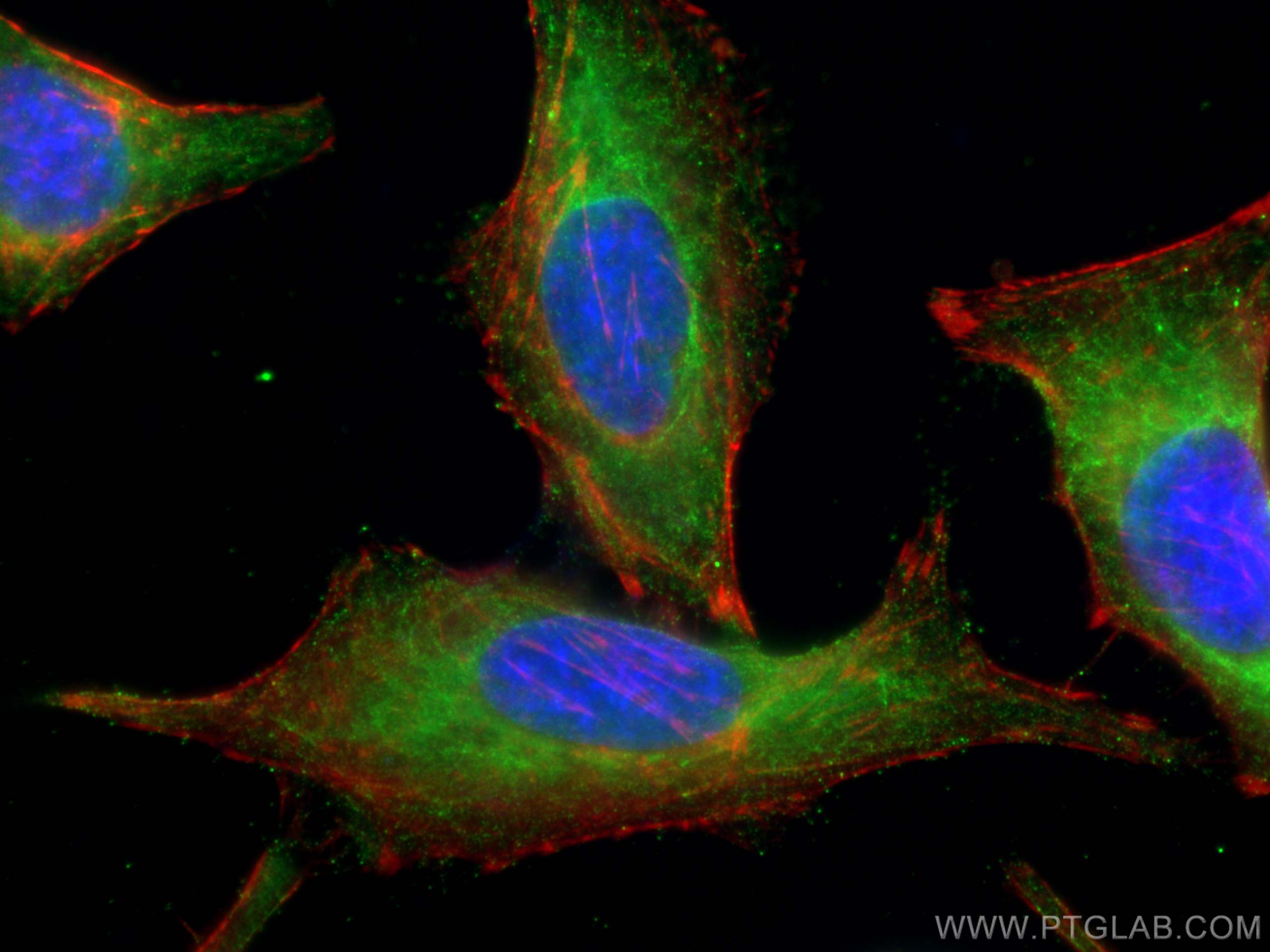 Immunofluorescence (IF) / fluorescent staining of HeLa cells using PLK4 Polyclonal antibody (28750-1-AP)