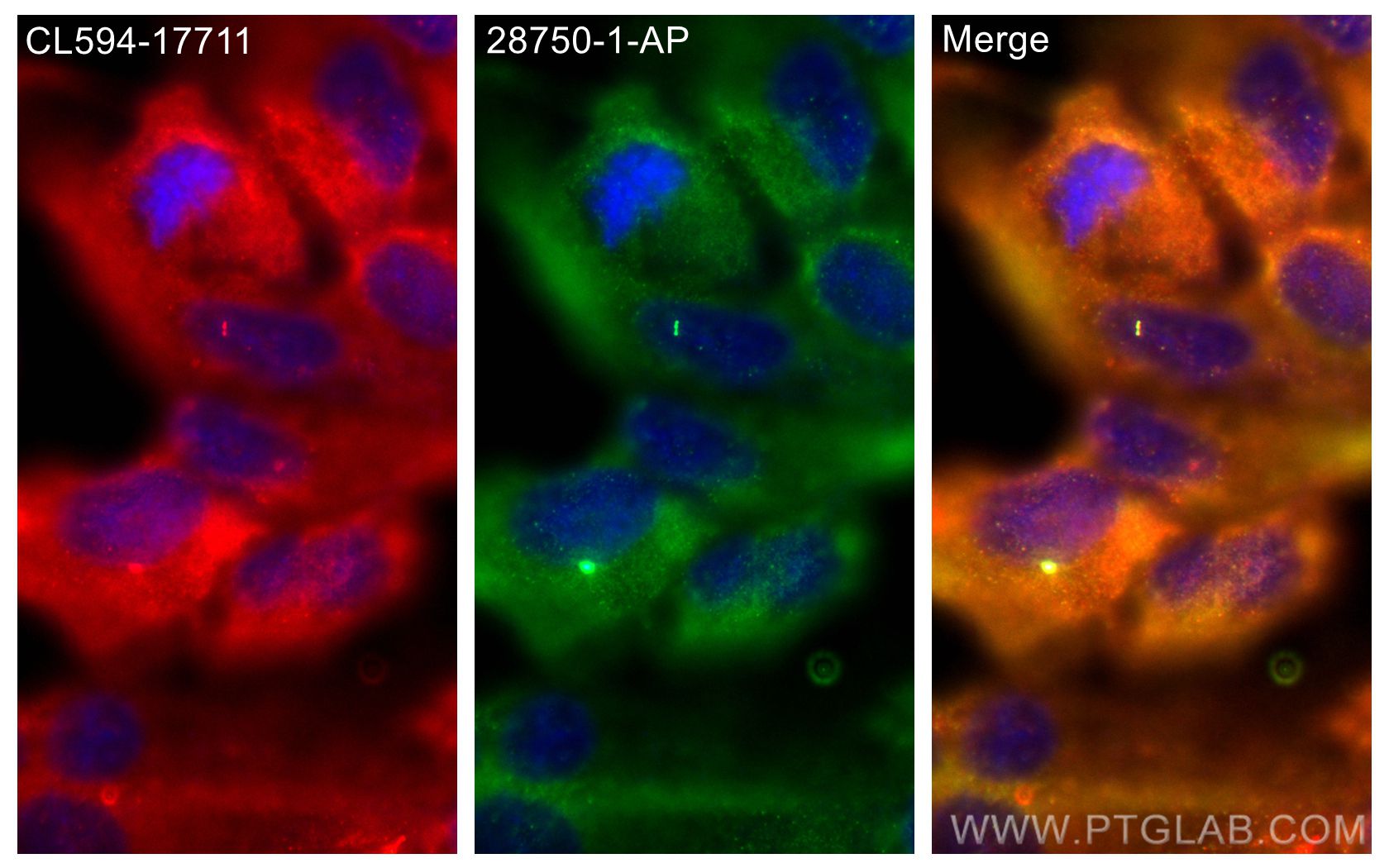 Immunofluorescence (IF) / fluorescent staining of hTERT-RPE1 cells using PLK4 Polyclonal antibody (28750-1-AP)