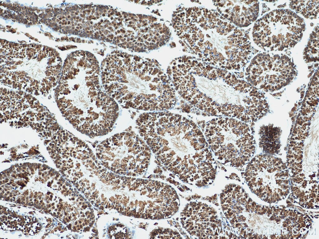 IHC staining of mouse testis using 28750-1-AP