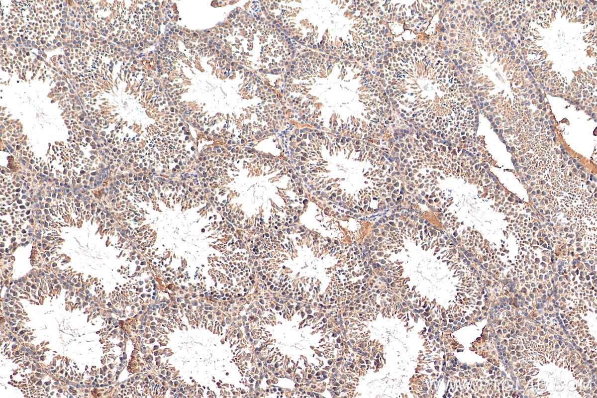 Immunohistochemistry (IHC) staining of mouse testis tissue using PLK4 Polyclonal antibody (28750-1-AP)