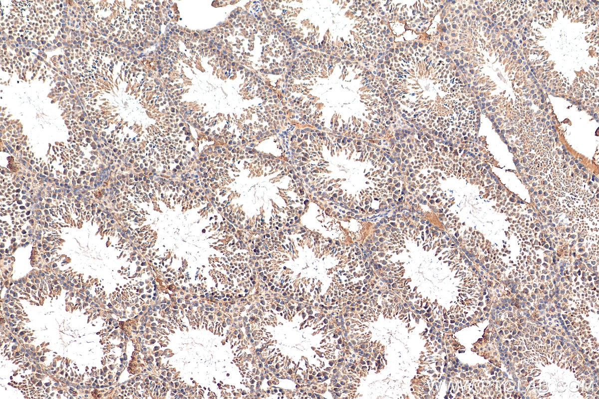 IHC staining of mouse testis using 28750-1-AP